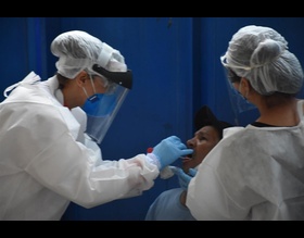 Prefeitura de Botucatu realiza testagem em pessoas em situação de rua